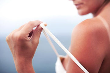 Most Effective Natural Remedies for Sunburn Relief